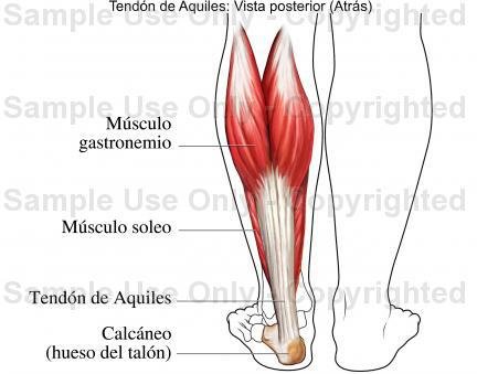 tendon-de-aquiles-4.jpg