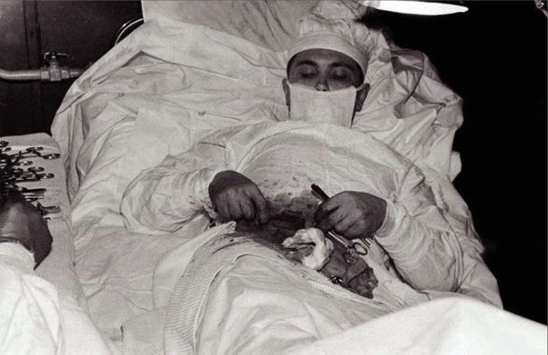 Dr. Leonid Rogozov operating himself to remove his appendix in Antarctica, 1961 (2).jpg