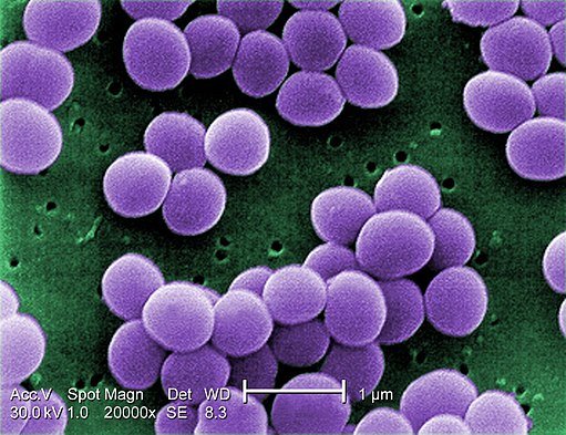 512px-Staphylococcus_aureus_VISA_2 (1).jpg