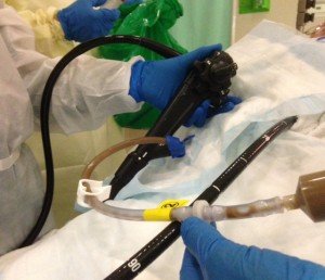 colonoscope-300x258.jpg