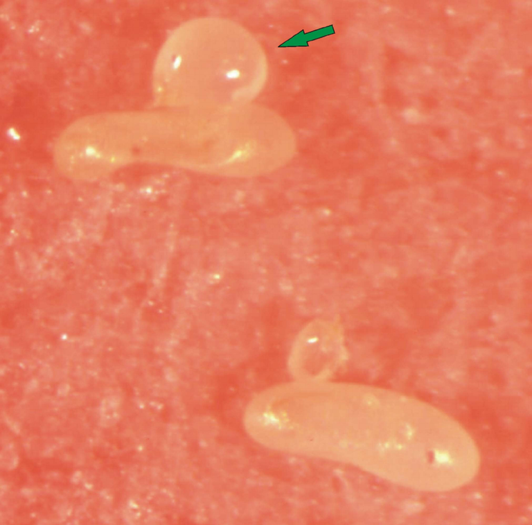 Fig-13-Female-physogastric-of-Adactylidium-gynaikothripsi-parasitizing-eggs-of.png