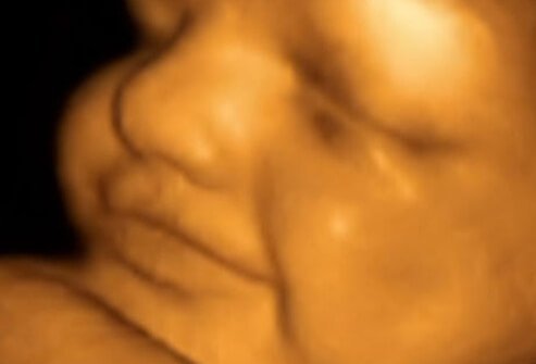fetal_ultrasound_24_weeks_s9.jpg