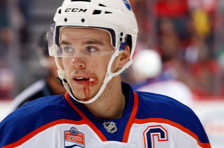 connor-mcdavid-cut-face.png