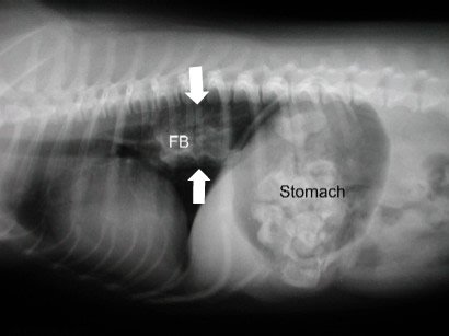 4. object in throat.jpg