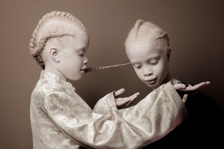 albino-twins-6.jpg