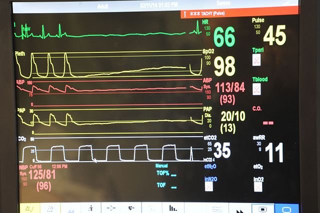 Vital_signs_monitor_display.jpg