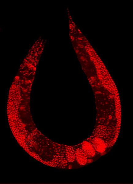 434px-C_elegans_stained.jpg