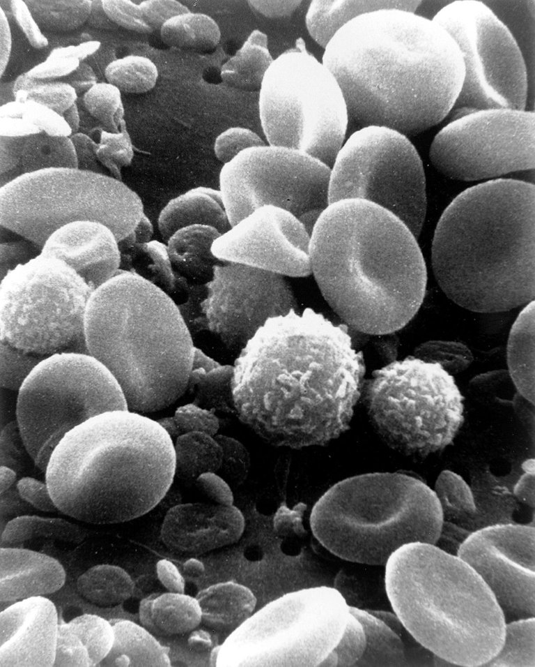 1200px-SEM_blood_cells.jpg