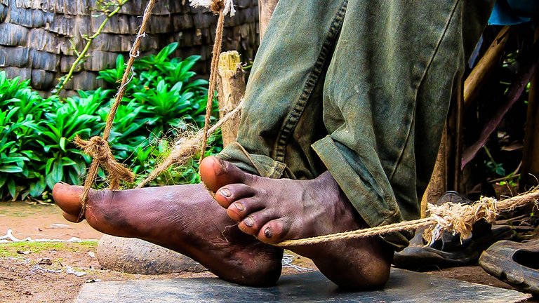 ethiopian weever feet.jpg