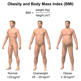 Obesity_&_BMI.png