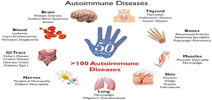 autoimmune-diseases-dosages-cannabis-oil[1].jpg