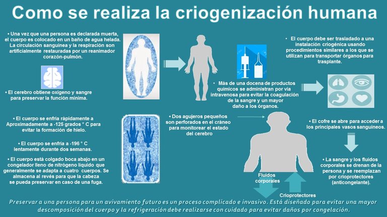 criogenización humana.jpg