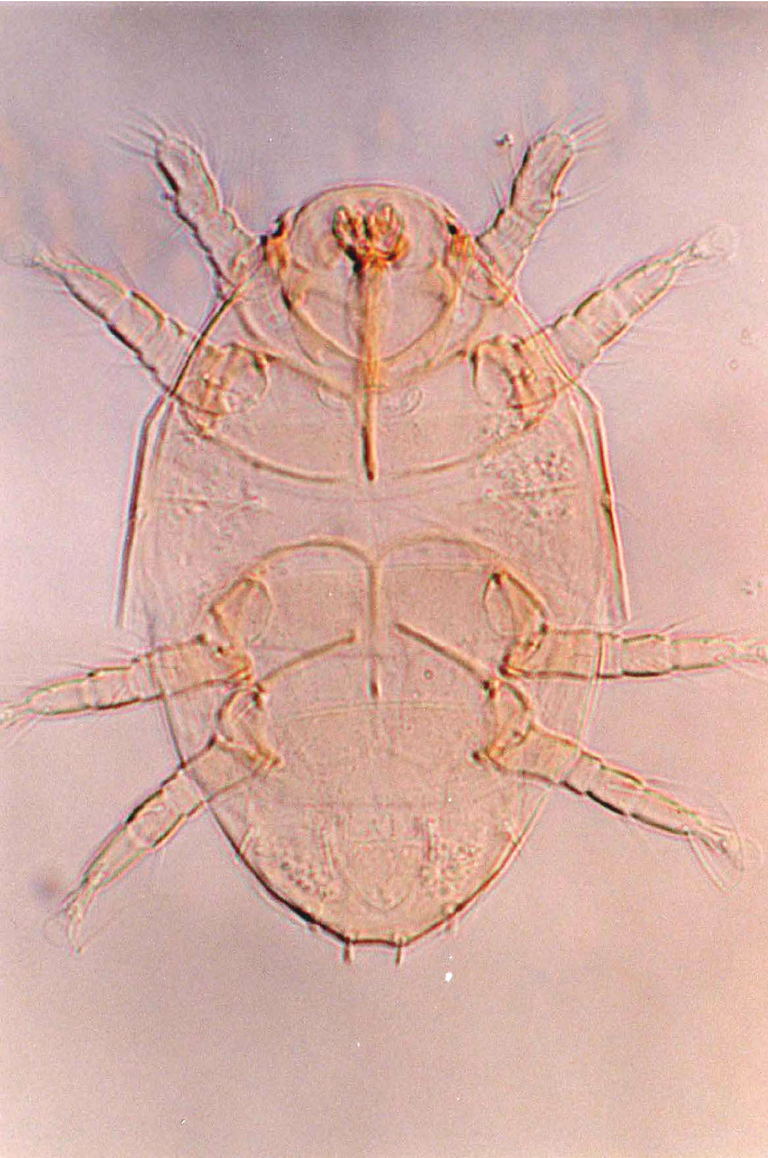 Fig-8-Adactylidium-gynaikothripsi-n-sp.png