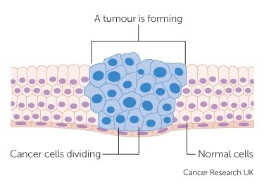 diagram-showing-how-cancer-cells-keep-on-reproducing-to-form-a-tumour_0.jpg