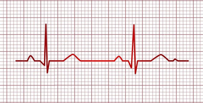 electrocardiograma.jpg