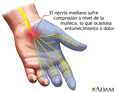 tunel de sindrome carpiano.jpg