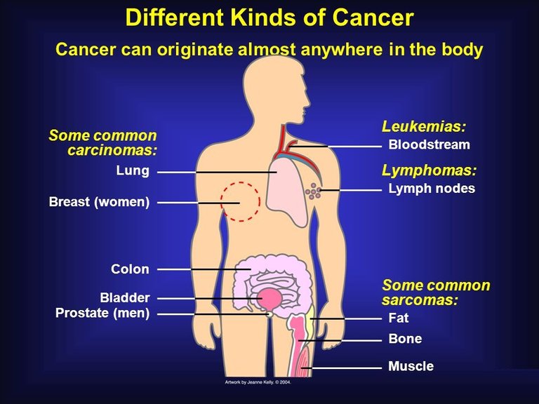 signs-and-symptoms-of-cancer.jpg