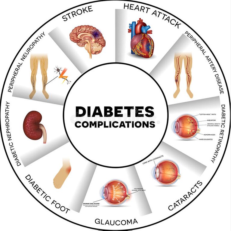 diabetes-complications-affected-organs-affects-nerves-kidneys-eyes-vessels-heart-brain-skin-round-info-graphic-62541059.jpg