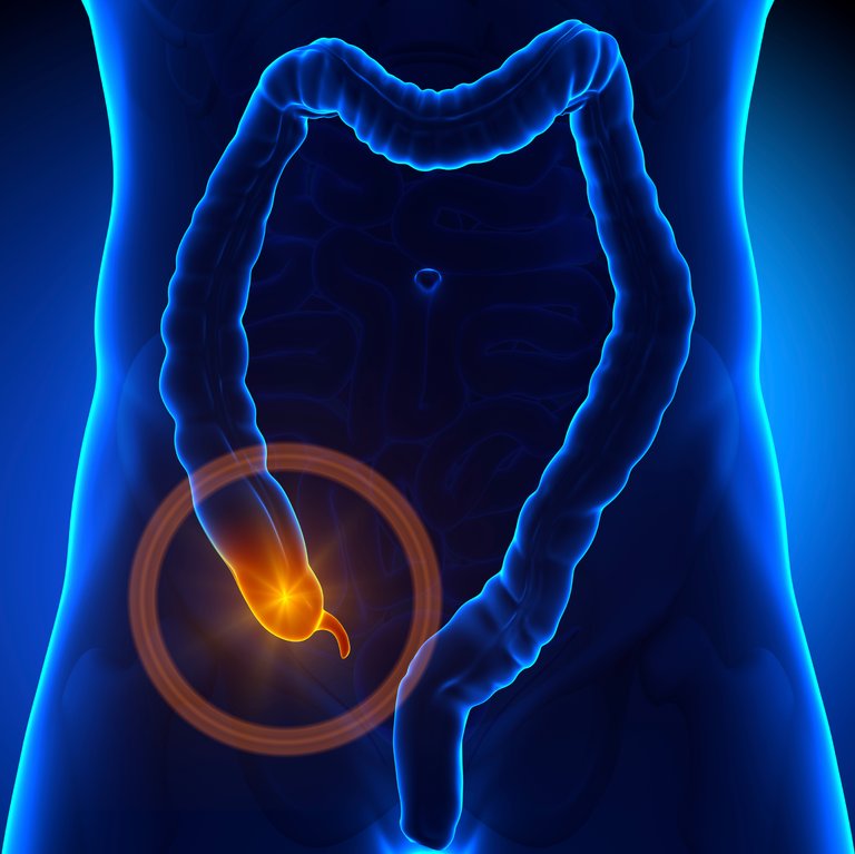 appendix-appendicitis.jpg