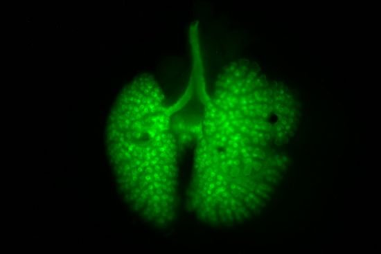 h_E14.5-lung-and-trachea.jpg