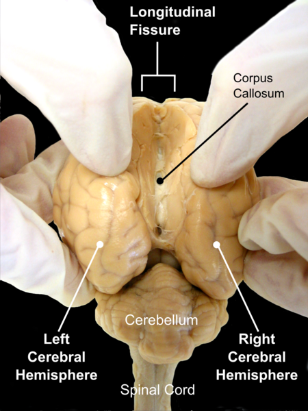 Sheep_Brain_Dissection_2_-_black_background_with_labels.png