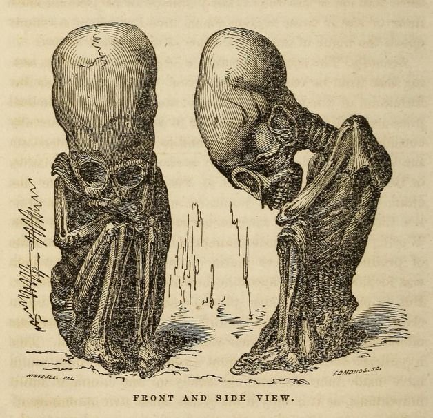 elongated skull lithogrpah.jpg