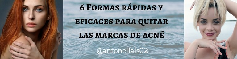 6 Formas rápidas y eficaces para quitar las marcas de acné.jpg