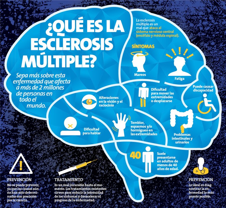 esclerosis cerebro.jpg