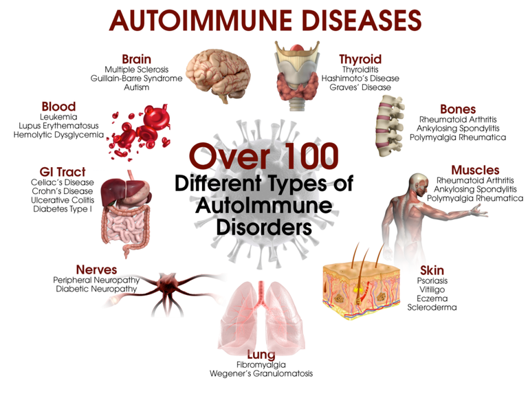 AutoImmune-1024x768.png