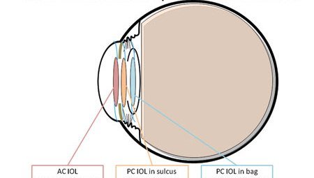 osnus08b12devgan2f3.jpg