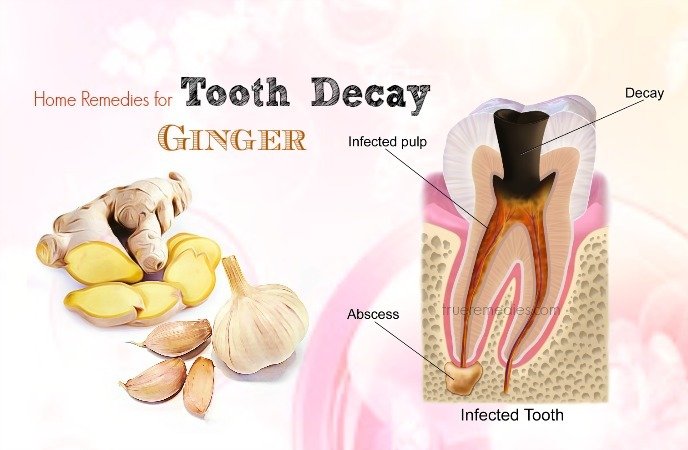 home-remedies-for-tooth-decay-ginger.jpg