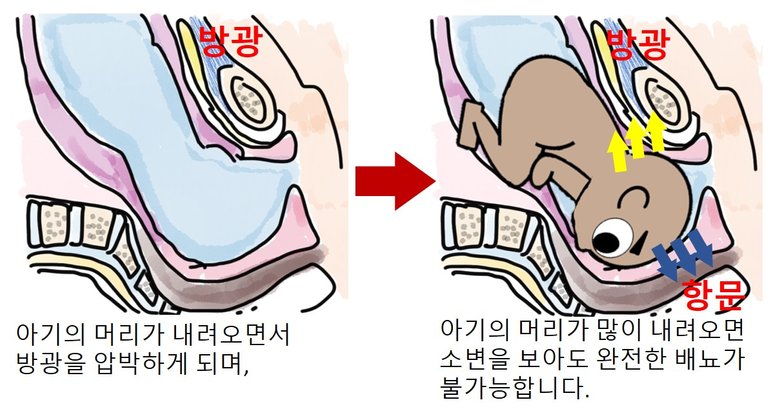 임신준비-3대 굴욕-관장과 내진7.jpg