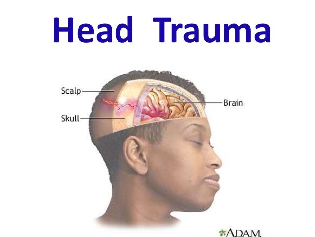 head-trauma-1-638.jpg