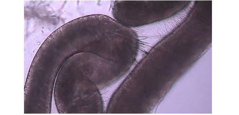 jellyfish microsc stinger.jpg