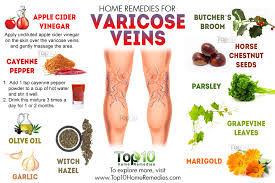 homeopathic remedies varicosis.png