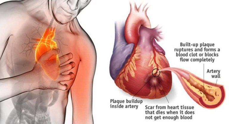 Here’s-How-To-Stop-A-Heart-Attack-In-60-Seconds-830x450.jpg