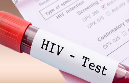 HIV-Test.jpg
