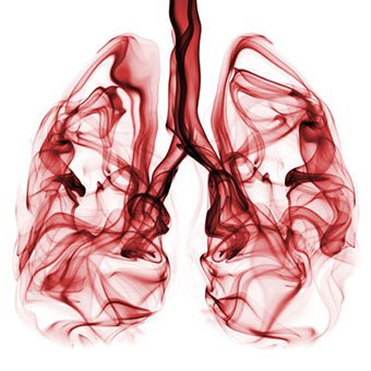 lung-cancer-s4-what-causes-lung-cancer.jpg