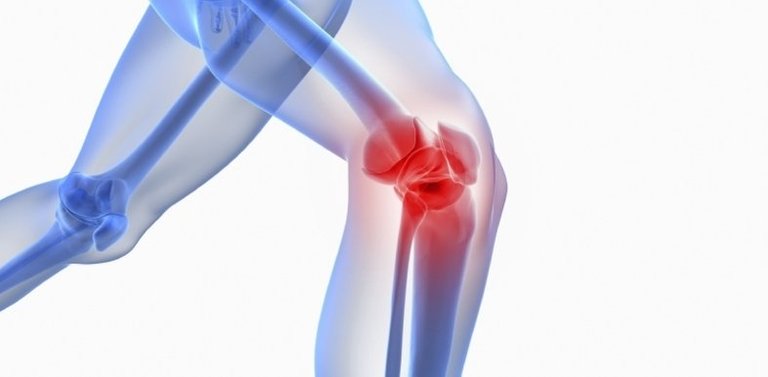 osteoarthritis-of-the-knee.jpg