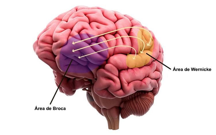 Broca-wernicke.jpg