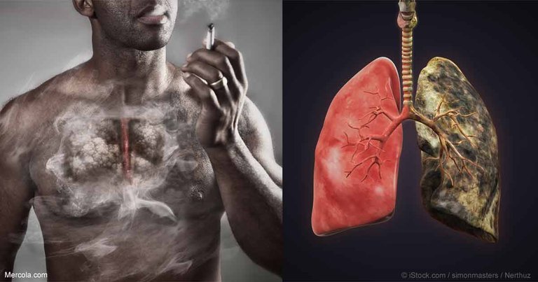 smoker-healthy-cancer-lungs-fb.jpg