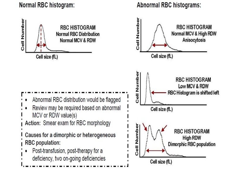 red cell histogram.jpg