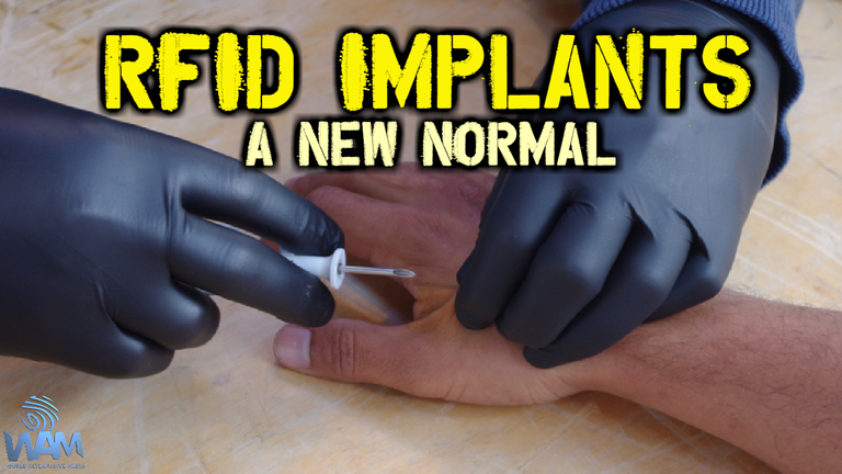 rfid implants a new normal thumbnail.png