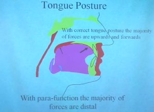 tongue-300x219.png