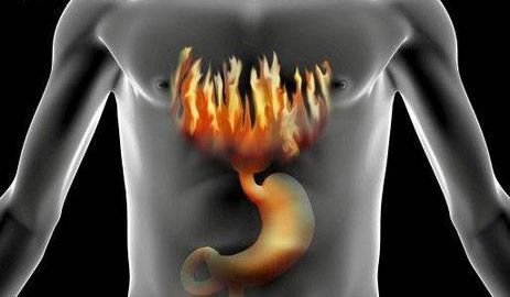 best-remedies-for-acid-reflux(1).jpg