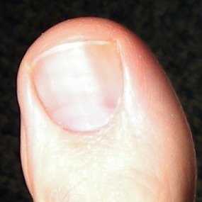 MyLeftBigToe2.jpg