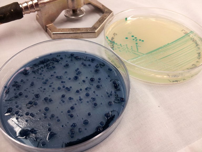 Salivarius and E. coli - Taken 8-29-2014.jpg