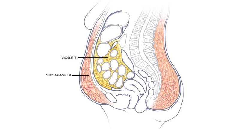and evisceral_fat_Mayo_Clinic.jpg