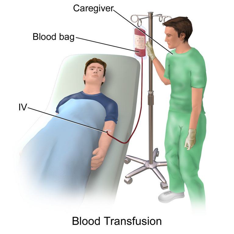 1024px-Blausen_0087_Blood_Transfusion.png