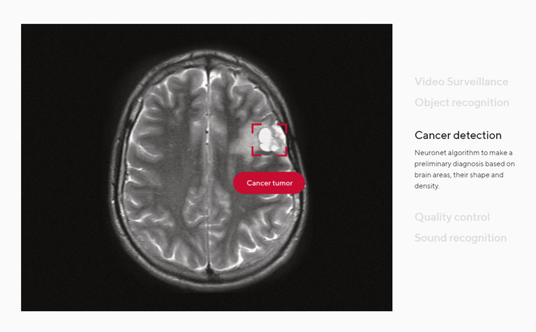 Dbrain (2).png